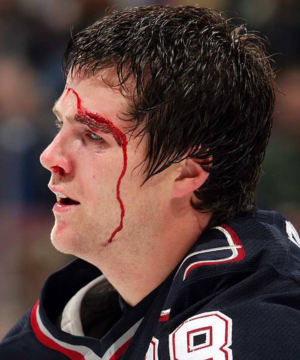 140424154209-brookbank-vinnick-single-image-cut.jpg